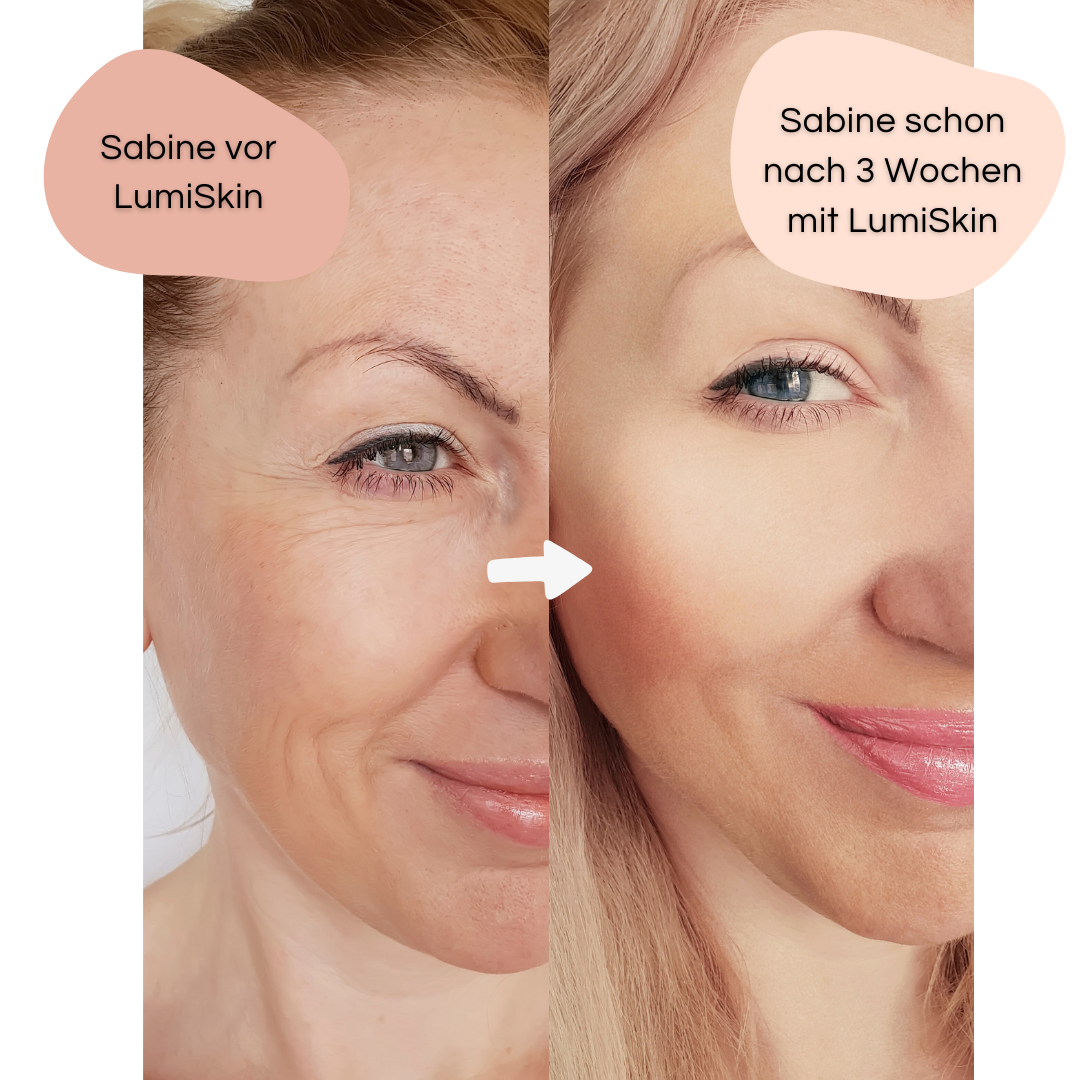 LumiSkin | Das Original